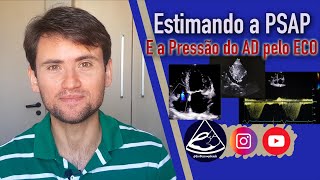 Como estimar a PSAP e a Pressão no Átrio Direito com o Ecocardiograma