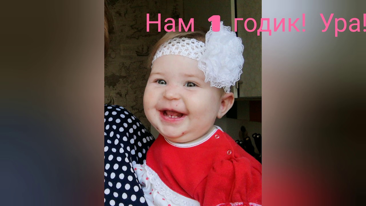 Нам годик! Синдром бабочки. Буллезный эпидермолиз - YouTube