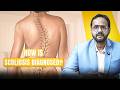 How Is Scoliosis Diagnosed? Tests & Assessments #spinespecialist #scoliosis #scoliosistreatment