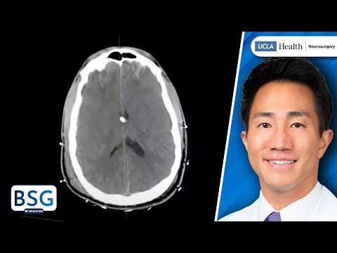 Video: Treatment Of Intracranial Pressure At Home, Folk Remedies