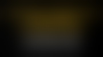 Laparoscopic Pyelolithotomy in a Horseshoe Kidney