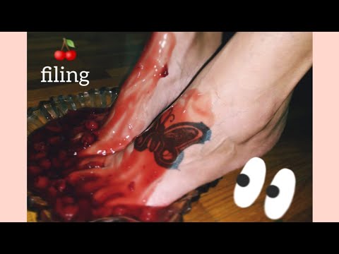 Cherry Fun