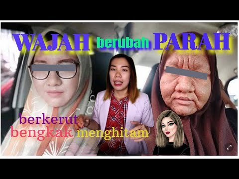 Video: Bagaimana Wajah Berubah Semasa Kehamilan