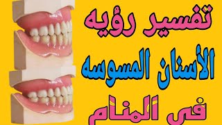 تفسير رؤيه الأسنان المسوسه في المنام/مامعني تسوس الأسنان في الحلم
