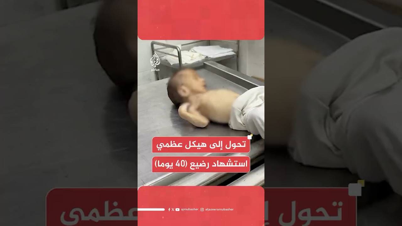 مراسل الجزيرة مباشر: استشهـ،ـاد طفل رضيع جراء المجاعة، وسوء تغذية ونفاد حليب الأطفال شمالي قطاع غزة