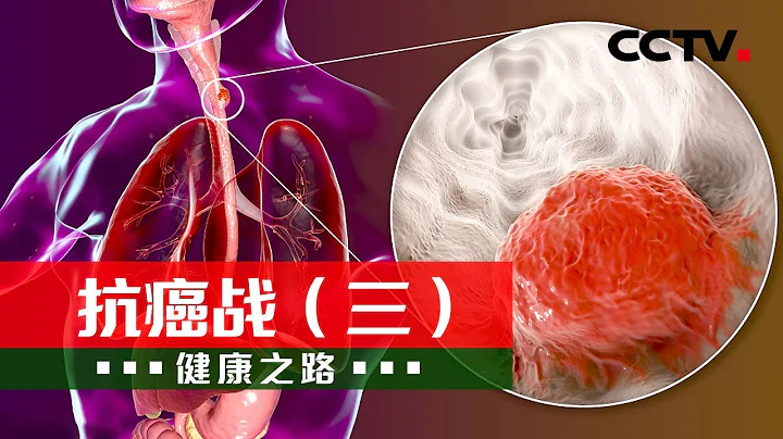 抗癌戰——剖析食管癌的防與治 20220416 |《健康之路》CCTV科教 - 天天要聞