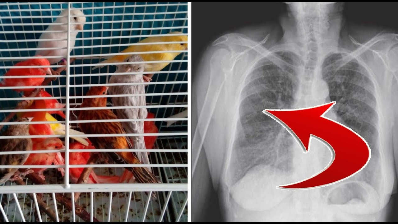 LA ENFERMEDAD DEL CRIADOR DE AVES (Una costumbre peligrosa)