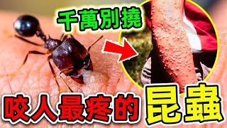 世界上“咬人最疼”的10種昆蟲！第一名堪比子彈擊穿手臂，被咬後千萬別撓！|#世界之最top #世界之最 #出類拔萃 #腦洞大開 #top10 #咬人最痛昆蟲