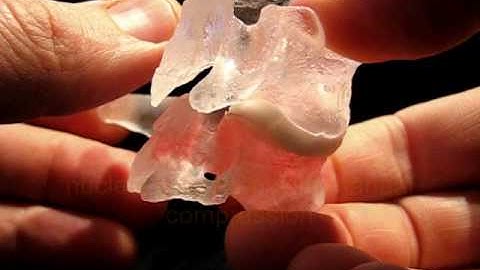 Vascular Clear Dynamic Cervical CxH by Dynamic Disc Designs Corp.