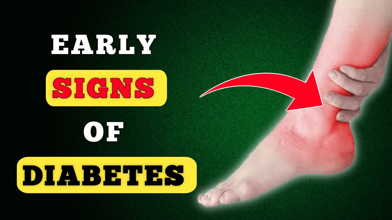DON'T IGNORE | These Are The First Signs You Have Diabetes