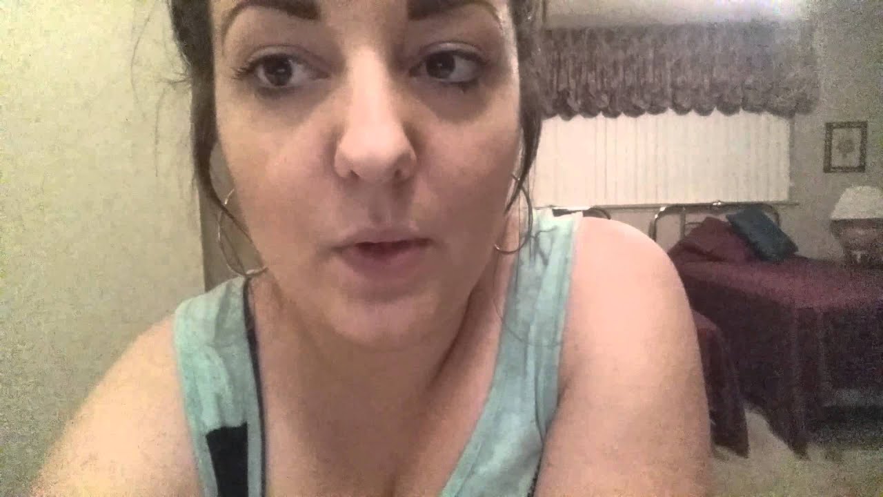 Gastric sleeve one month post op YouTube