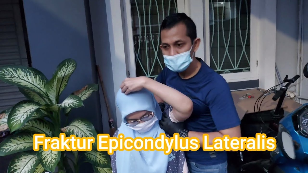 Latihan patah tulang siku ||fraktur ||Epicondylus Lateralis