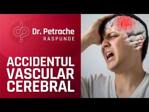 Video: Diabet și Accident Vascular Cerebral: Există O Conexiune?