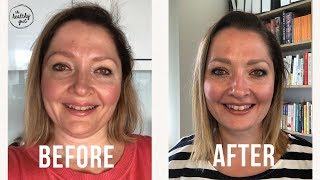Full 14 Days on The Elemental Diet for SIBO: Before and After Results with Rebecca Coomes Update