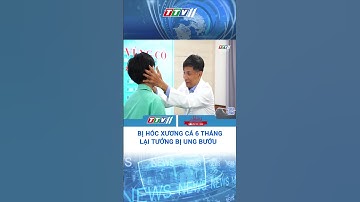 Bị hóc xương cá 6 tháng lại tưởng bị ung bướu #Shorts