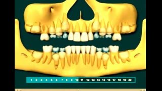 Eruption Teeth mp4