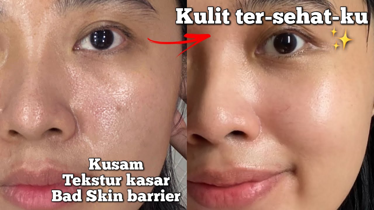 SKINCARE TERBAIK 2022 ATASI KUSAM, KULIT KASAR +PERBAIKI SKIN BARRIER