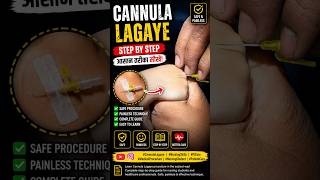 IV Cannulation Full Tutorial 😮 |Pain Less Method NursingSkills #MedicalProcedure #Shorts #ytshorts