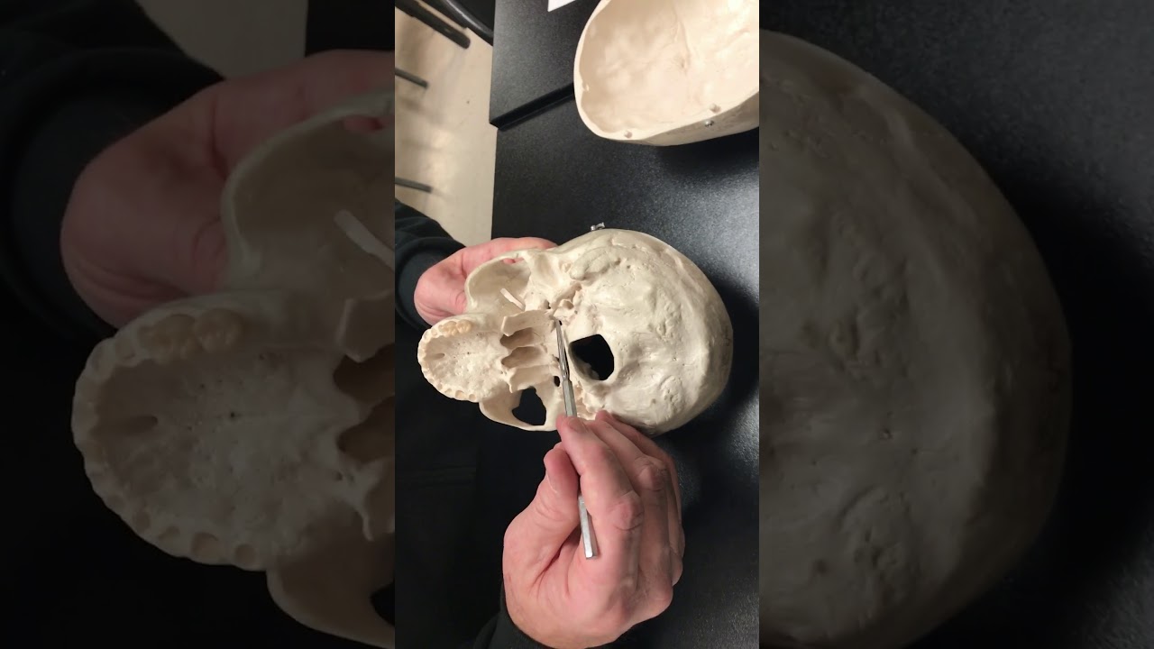 The bones of the skull - YouTube