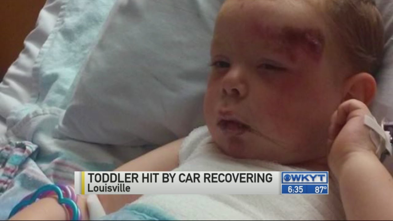 Toddler hit by car recovering - YouTube