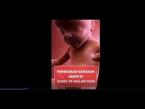 Video: Semasa ultrasound bayi sangat aktif?