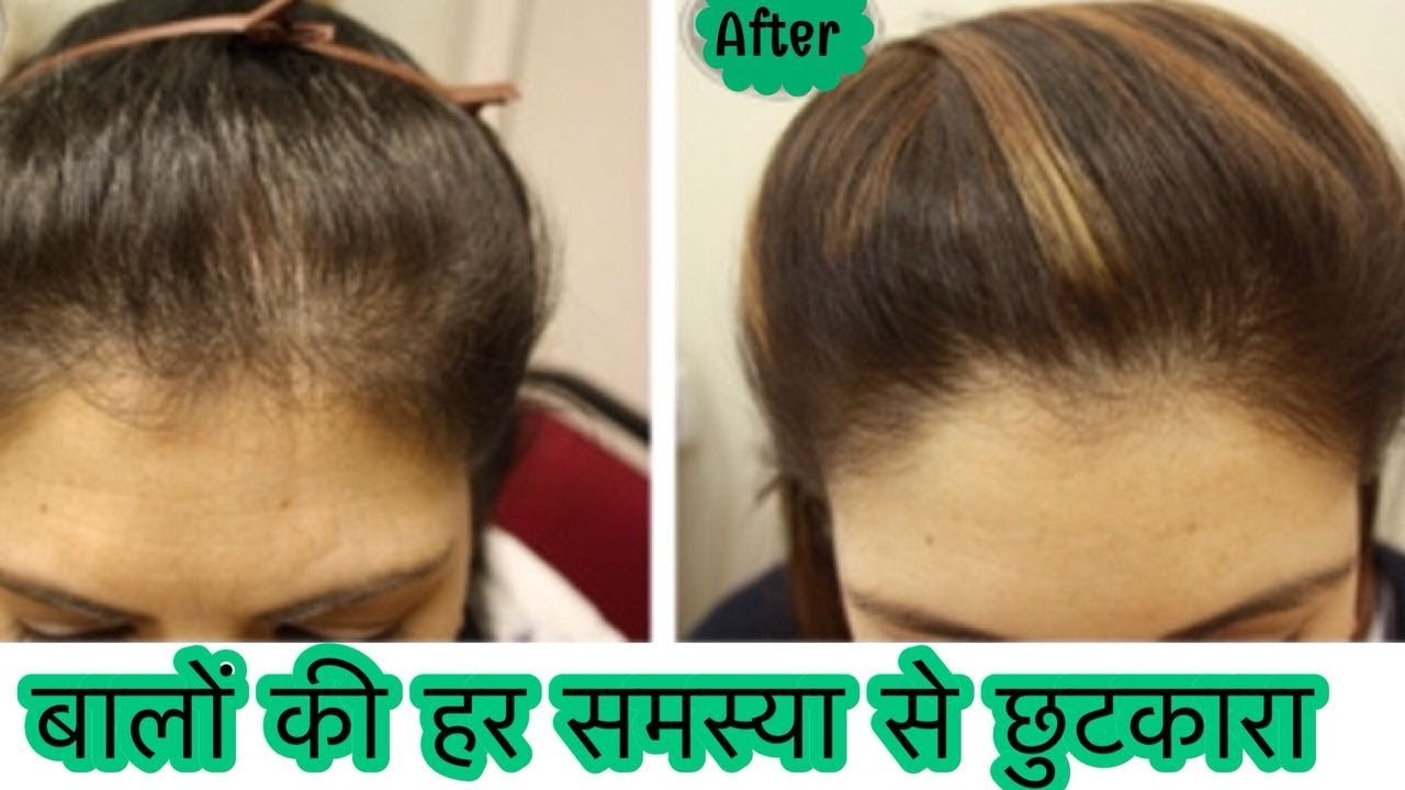 Diy Hair Growth Oil Stop Hair Fall Hair Loss How To Grow Long