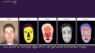 Multispectral imaging for skin analysis - Spectricity