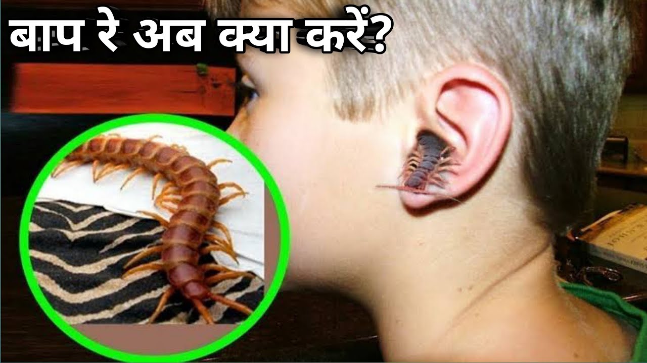 क्या होता है जब कनखजूरा कान में में चला जाता है | centipede facts in ...