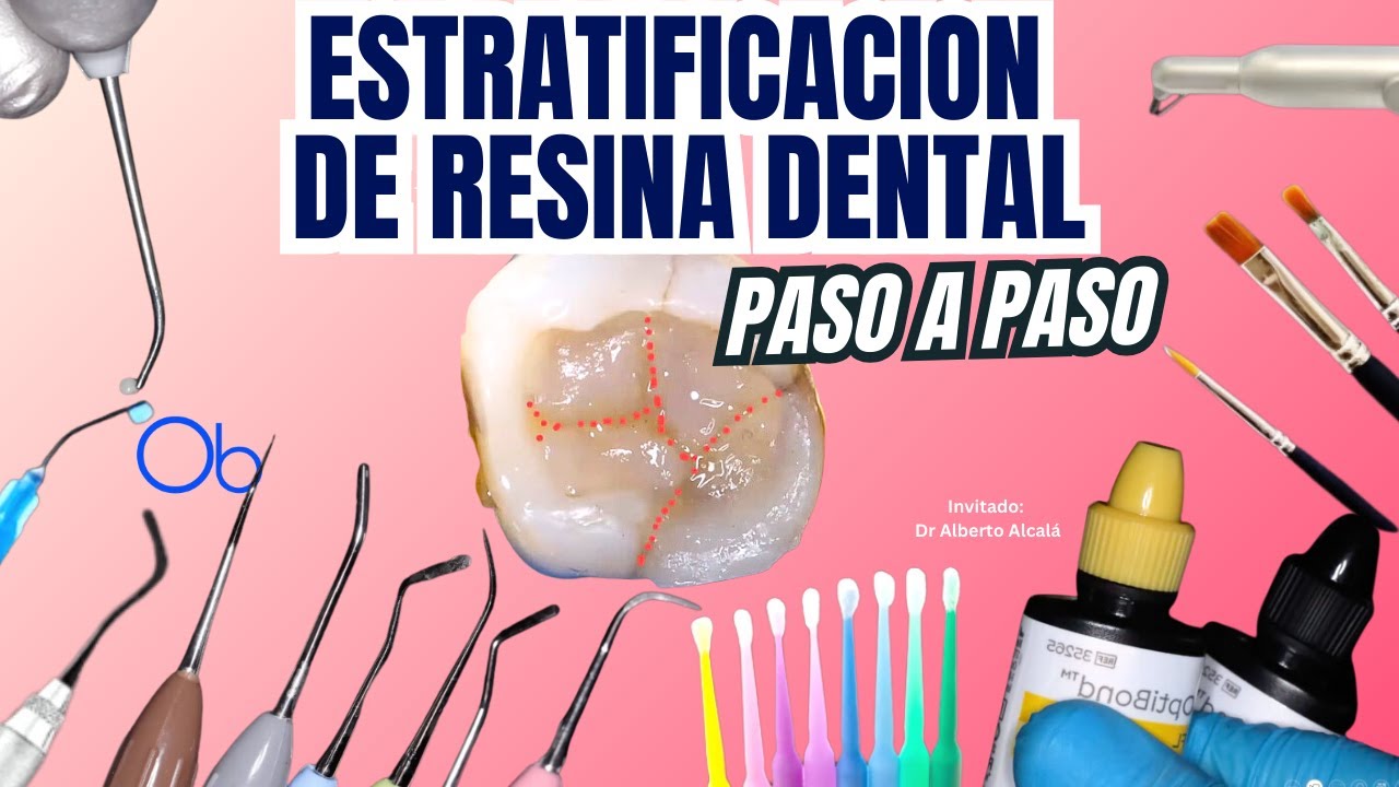 Estratificación de Resina Dental paso a paso: resinas, material