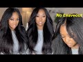 Leave out or No leave out, what’s better? MUST HAVE Easy Install V part Wig|Beauty Forever Hair