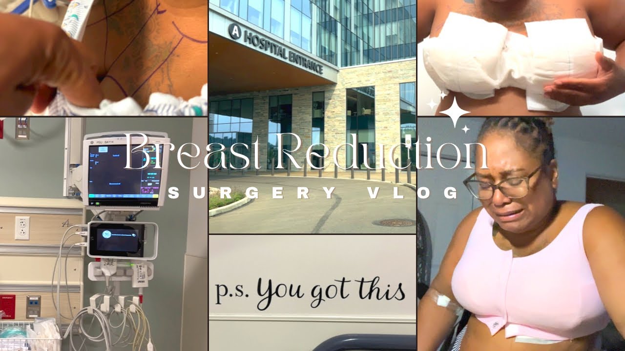 Realistic Breast Reduction Surgery W/ Lift & lipo l 1 Week Post Op
