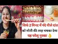 सिर्फ 2 मिनट में पीले गंदे दांतों को मोती की तरह चमका देगा यह घरेलू नुस्खा ! White teeth home remedy