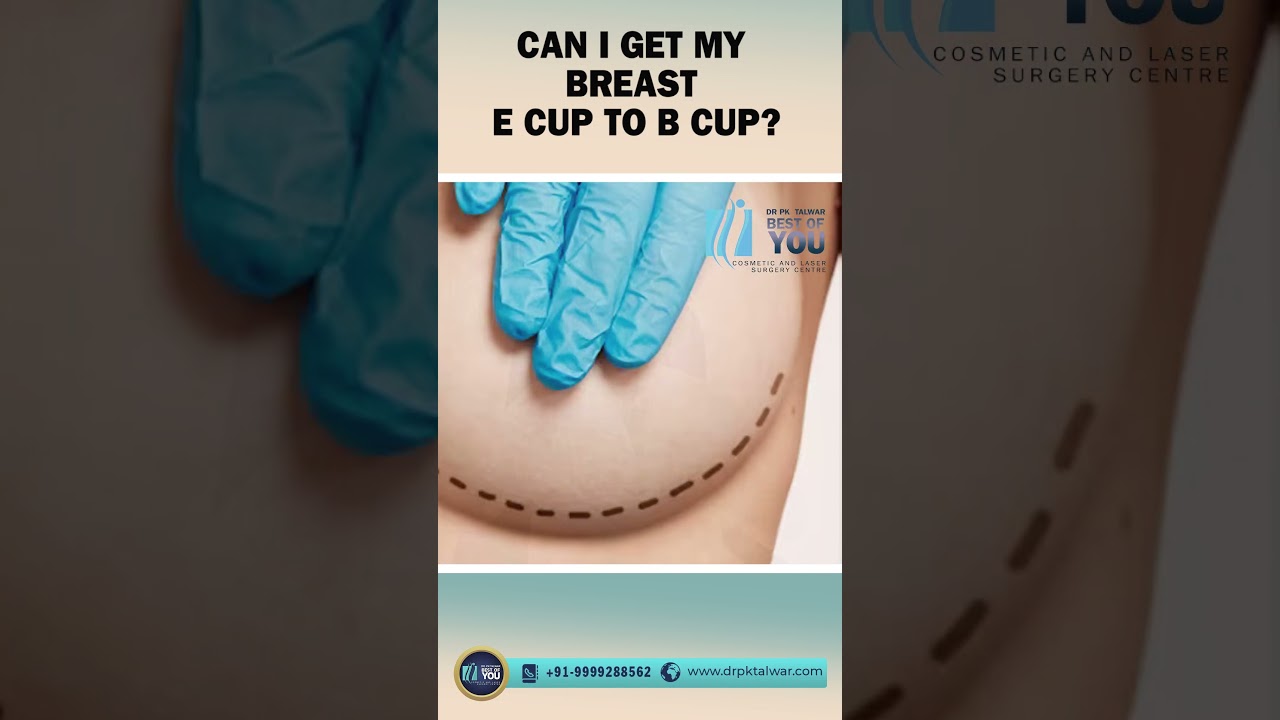 Transforming from an E Cup to a B Cup: Breast Reduction Surgery Explained
