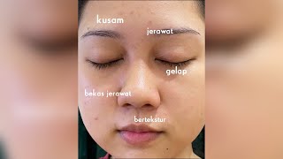 Kasih Tau Aku Alasan Kalian Gapake Sunscreen Dikolom Komentares shorts sunscreen trending