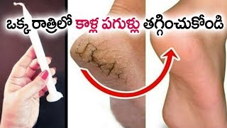in Just 5 Minutes - Get Rid Of CRACKED HEELS Permanently, Magical Cracked Heels Home Remedy