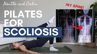 10 minute Pilates for Scoliosis (Fixed my spine for good!)