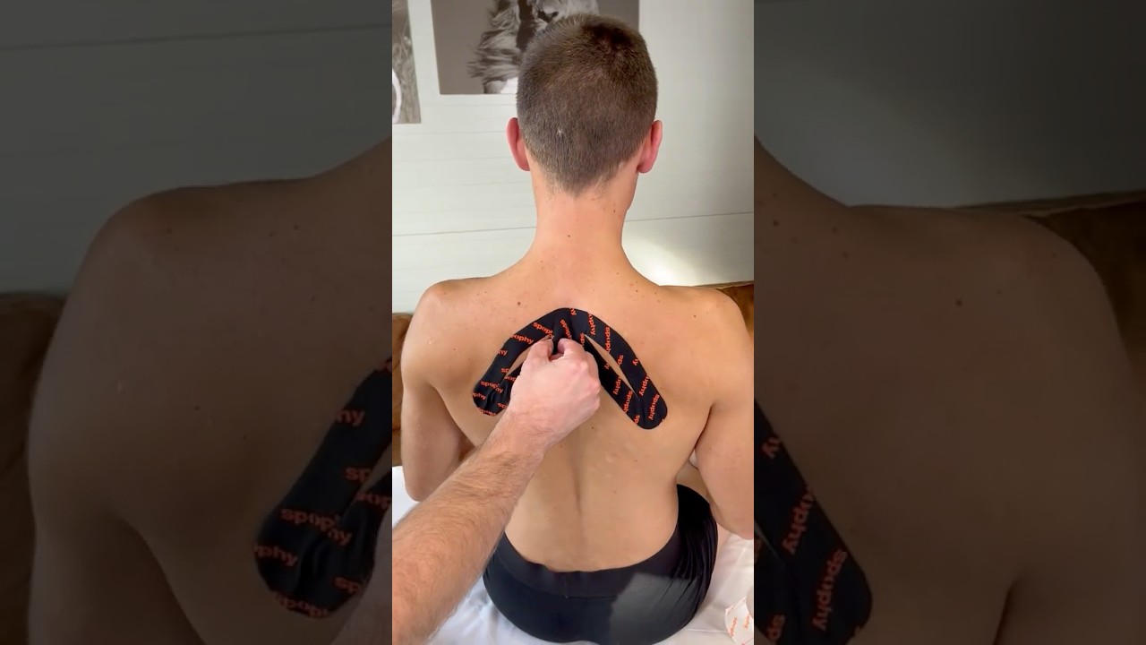 Activation of rhomboid muscles with Spophy kinesiology tape
