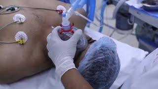 Young Boy goes under deep sleep before Anesthesia - Intubation Anesthesia