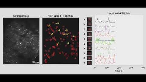 In-Vivo Imaging of the Neuronal Activity in Mouse Primary Visual Cortex