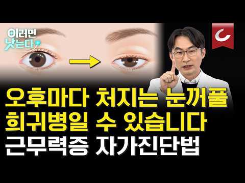 오후마다 처지는 눈꺼풀, 안과 질환이 아닙니다! 중증근무력증 위험 신호 2가지 [세브란스와 함께하는 희귀질환 극복 프로젝트ㅣ중증근무력증] 신하영 세브란스병원 신경과ㅣ이러면 낫는다