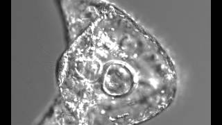 Sea urchin embryo
