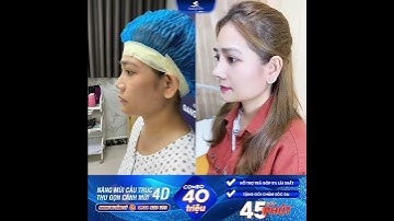 Nâng Mũi Cấu Trúc 4D + Thu Gọn Cánh mũi - Combo Kiến Tạo Dáng Mũi Đẹp Toàn Diện
