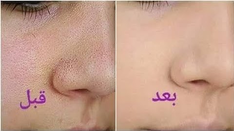 ماسك طبيعي للوجه مكونات متواجدة فكل بيت رائع لنظارة البشرة وضد التصبغات الجلدية وضد لتجاعيد #اكسبلور