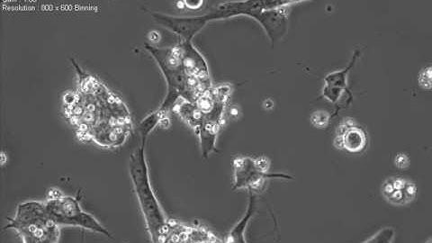 Mouse iPS cells Differentiating into Neurons