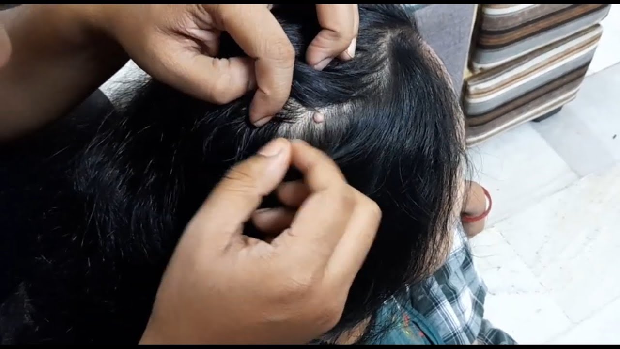 ASMR 😴Son's style 🙆mom's white hair and scalp checking, nitpicking for sleep😴😴🌜✨💫