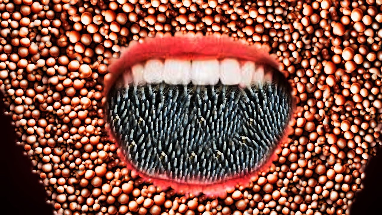 ASMR removal cysts infected face ASMR removal dead maggot infection