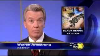 Black Henna tattoos can leave permanent damage