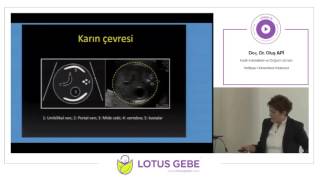 DOÇ. DR. OLUŞ APİ - FETAL BÜYÜMENİN DEĞERLENDİRİLMESİ