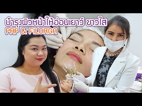 รีวิวฉีด PRP และบำรุงผิวหน้าด้วยสเต็มเซลล์ FILORGA ที่คลินิกเชียงใหม่