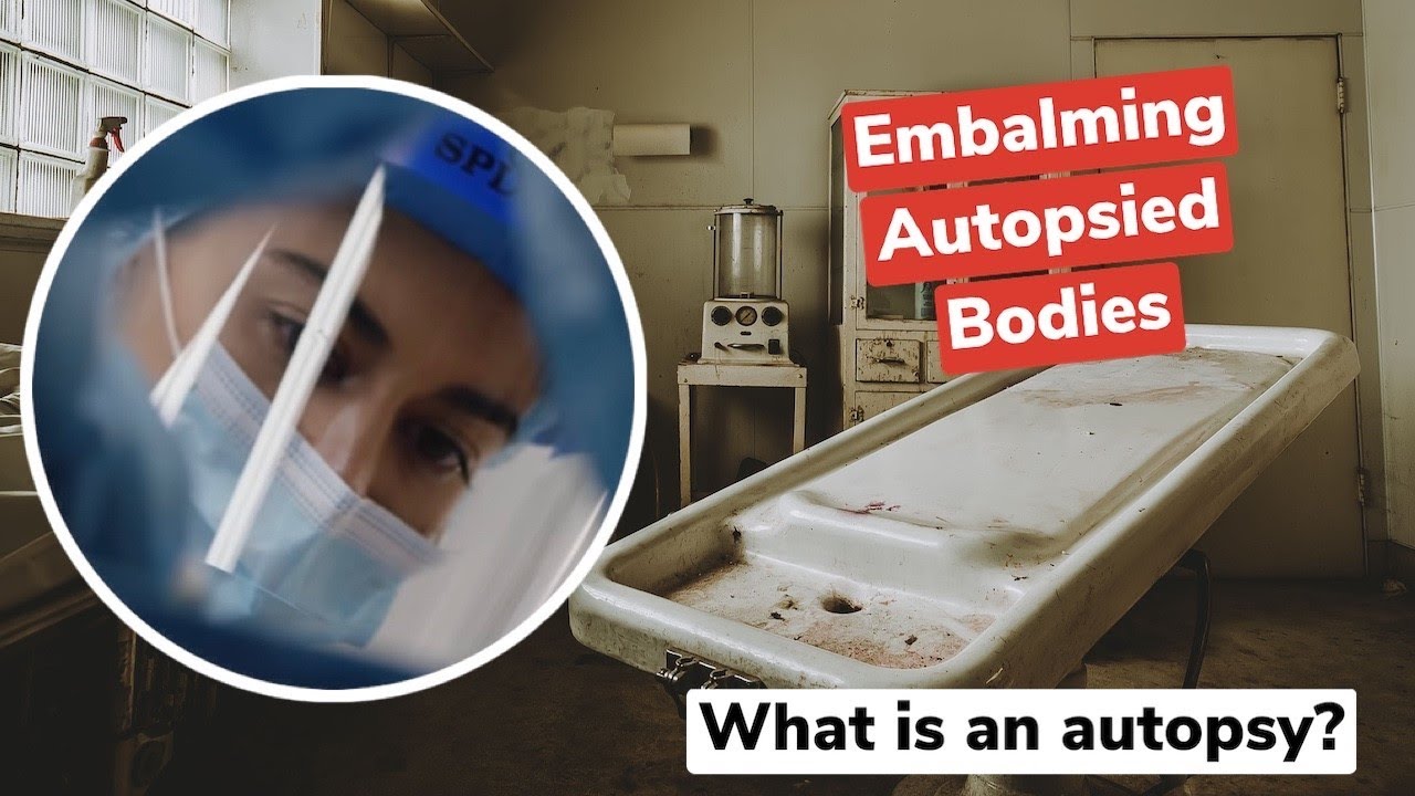What Is An Autopsy YouTube what-is-an-autopsy-youtube